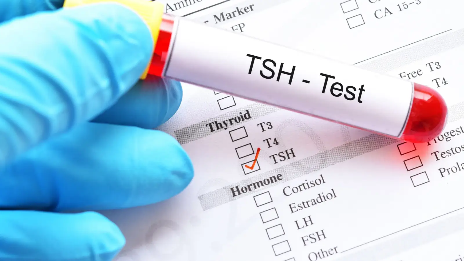 اعرف الان سعر تحليل TSH دليلك الشامل لفهم أهميته
